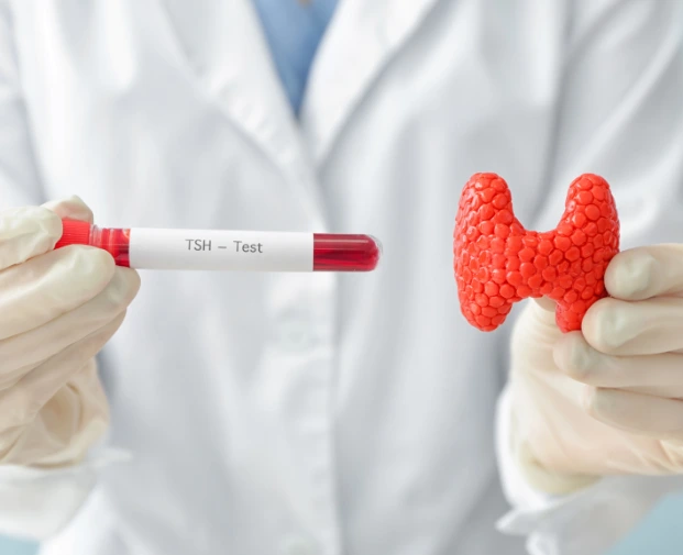 A person in a white lab coat and gloves holds a blood sample tube labeled "TSH - Test" in one hand and a red, textured thyroid gland model in the other, against a blurred background.