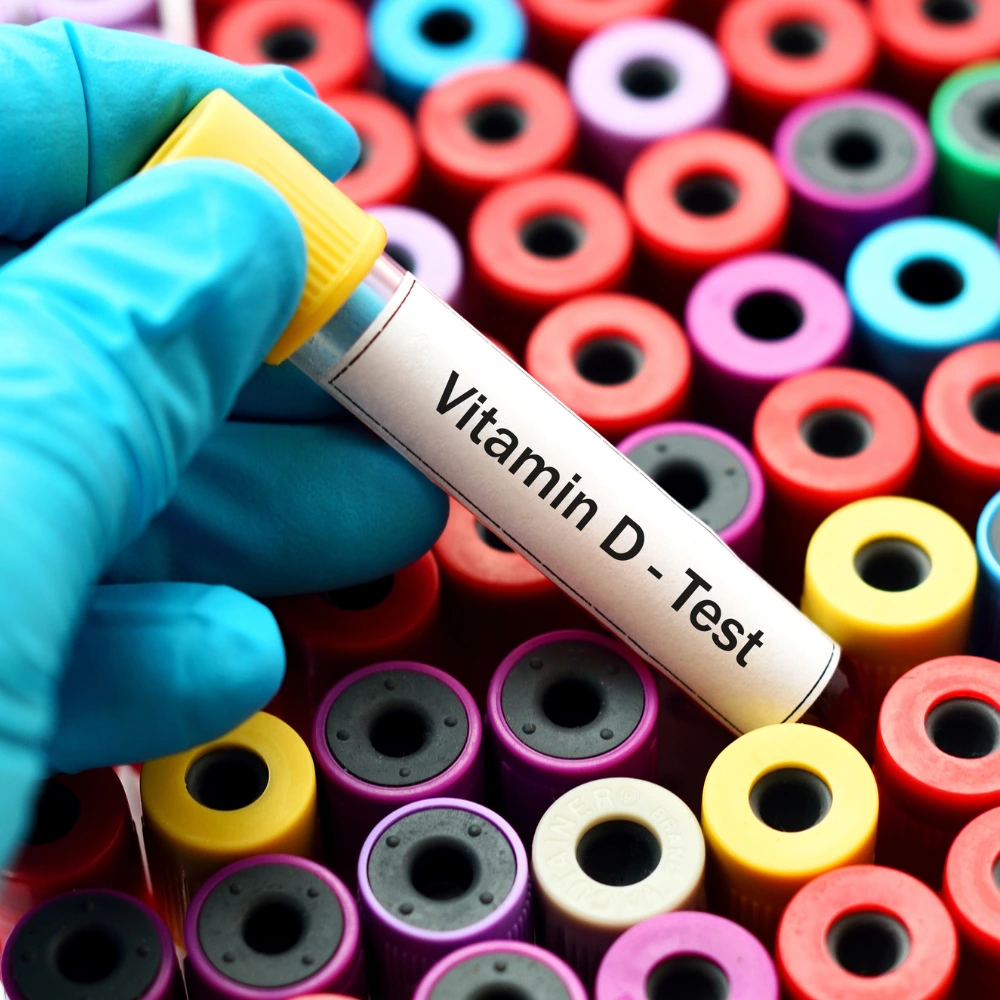 A gloved hand holds a test tube labeled "Vitamin D - Test" with a yellow cap, surrounded by a colorful array of other test tubes with various colored caps arranged in a background.
